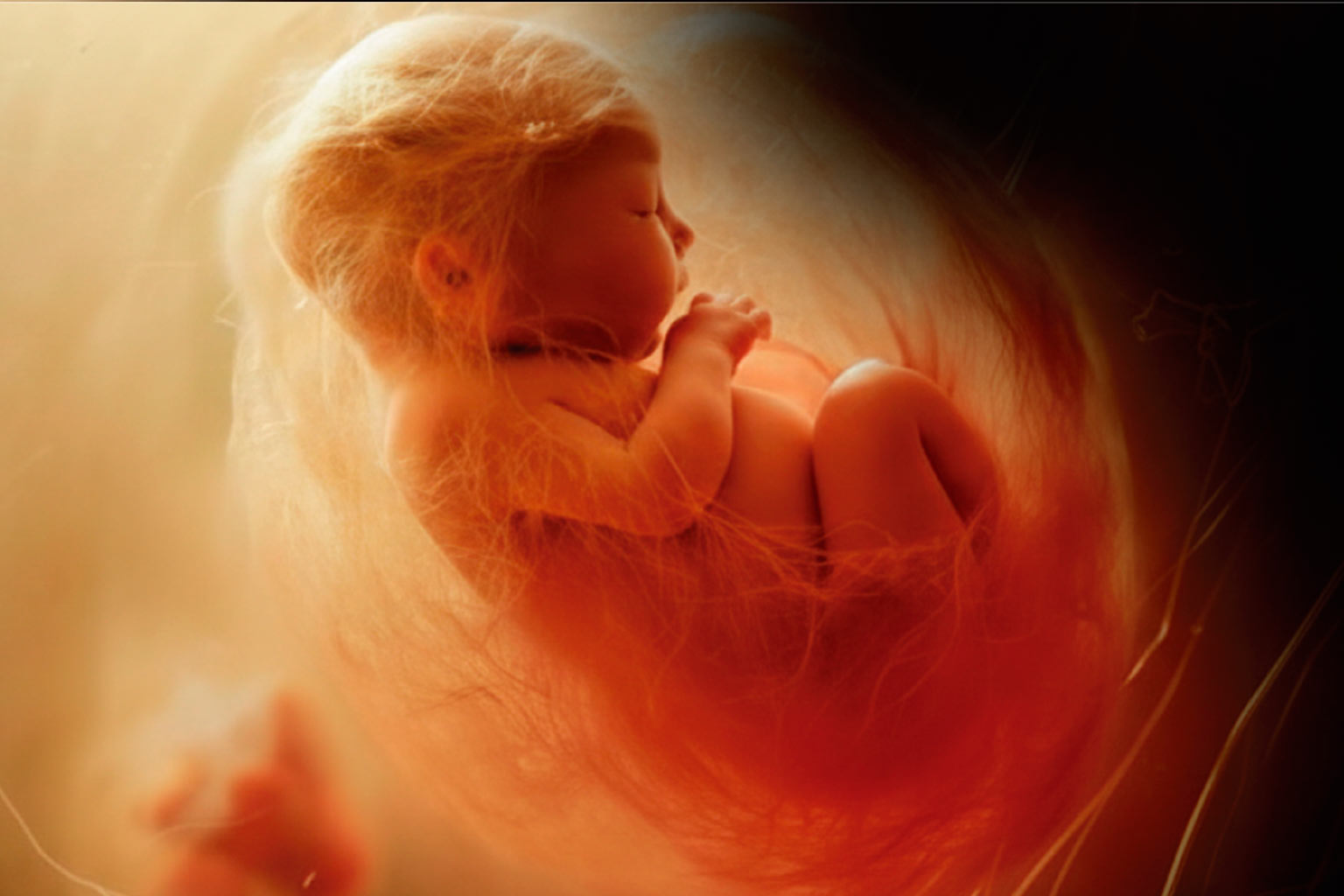Diplomado en Medicina Fetal 2026 - 2027