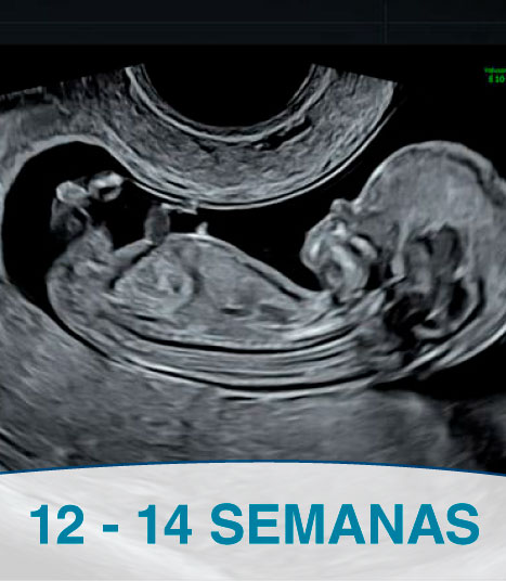 ecografia-genetica-en-lima-peru-instituto-peruano-de-medicina-y-cirugia-fetal